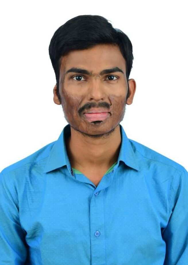 SAMBU ANIL